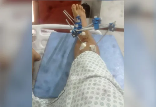 Jovem denuncia agressão de PMs dentro de hospital no sul do Tocantins