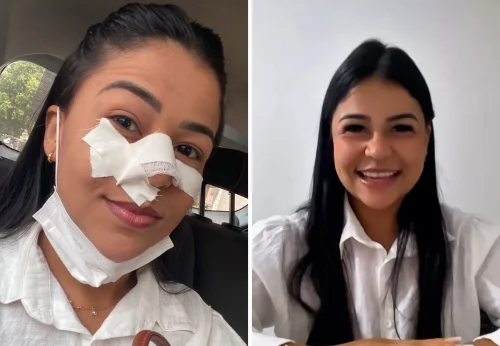 Jovem de 27 anos usa redes sociais para compartilhar luta contra leucemia mieloide crônica